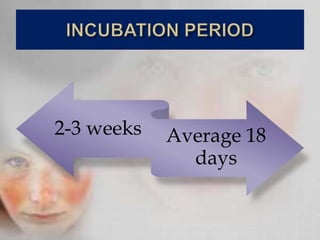 2-3 weeks Average 18
days
 
