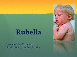 Rubella
Presented By- Dr. Kunal
Guided By- Dr. Abhay Mudey
 