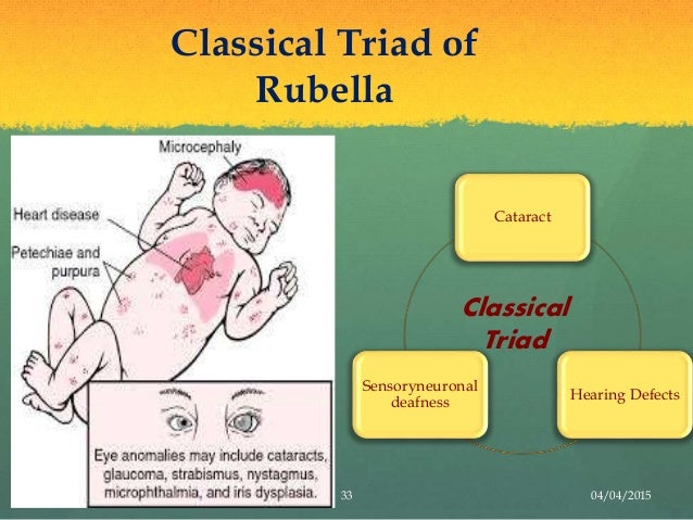Rubella (Seminar)