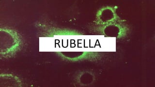 RUBELLA
 