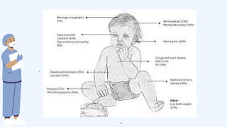 Rubella in Neonates: Causes, Symptoms, and Management | PDF