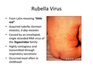 Rubella infection | PPTX