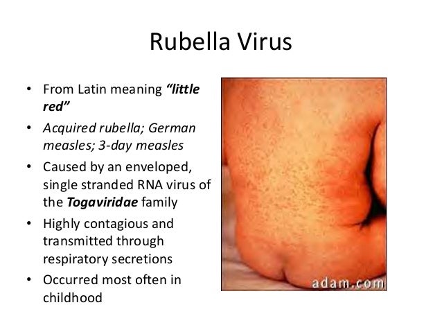 rash caused by virus