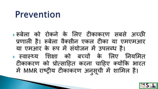  रूबेला को रोकने क
े ललए टीकाकरण सबसे अच्छी
प्रणाली है। रूबेला वैक्सीन एकल टीका या एमएमआर
या एमआर क
े रूप में संयोिन में उपलब्ि है।
 थवाथ्य लशक्षा को बच्चों क
े ललए तनयलमत
टीकाकरण को प्रोत्सादहत करना चादहए क्योंकक भारत
में MMR राटरीय टीकाकरण अनुसूची में शालमल है।
 