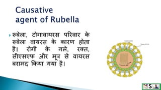  रूबेला, टोगावायरस पररवार क
े
रूबेला वायरस क
े कारण होता
है। रोगी क
े गले, रक्त,
सीएसएफ और मूत्र से वायरस
बरामद ककया गया है।
 