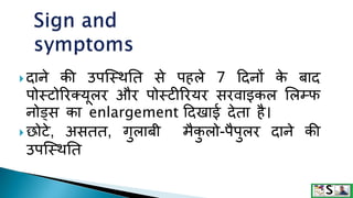  दाने की उपजथथतत से पहले 7 ददनों क
े बाद
पोथटोररक्यूलर और पोथटीररयर सरवाइकल ललम्फ
नोड्स का enlargement ददखाई देता है।
 छोटे, असतत, गुलाबी मैक
ु लो-पैपुलर दाने की
उपजथथतत
 