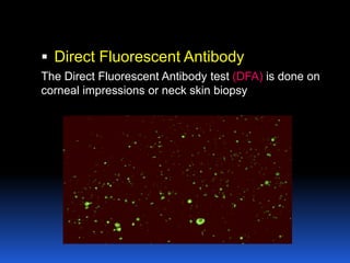  Direct Fluorescent Antibody
The Direct Fluorescent Antibody test (DFA) is done on
corneal impressions or neck skin biopsy
 