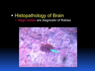  Histopathology of Brain
  Negri bodies are diagnostic of Rabies
 