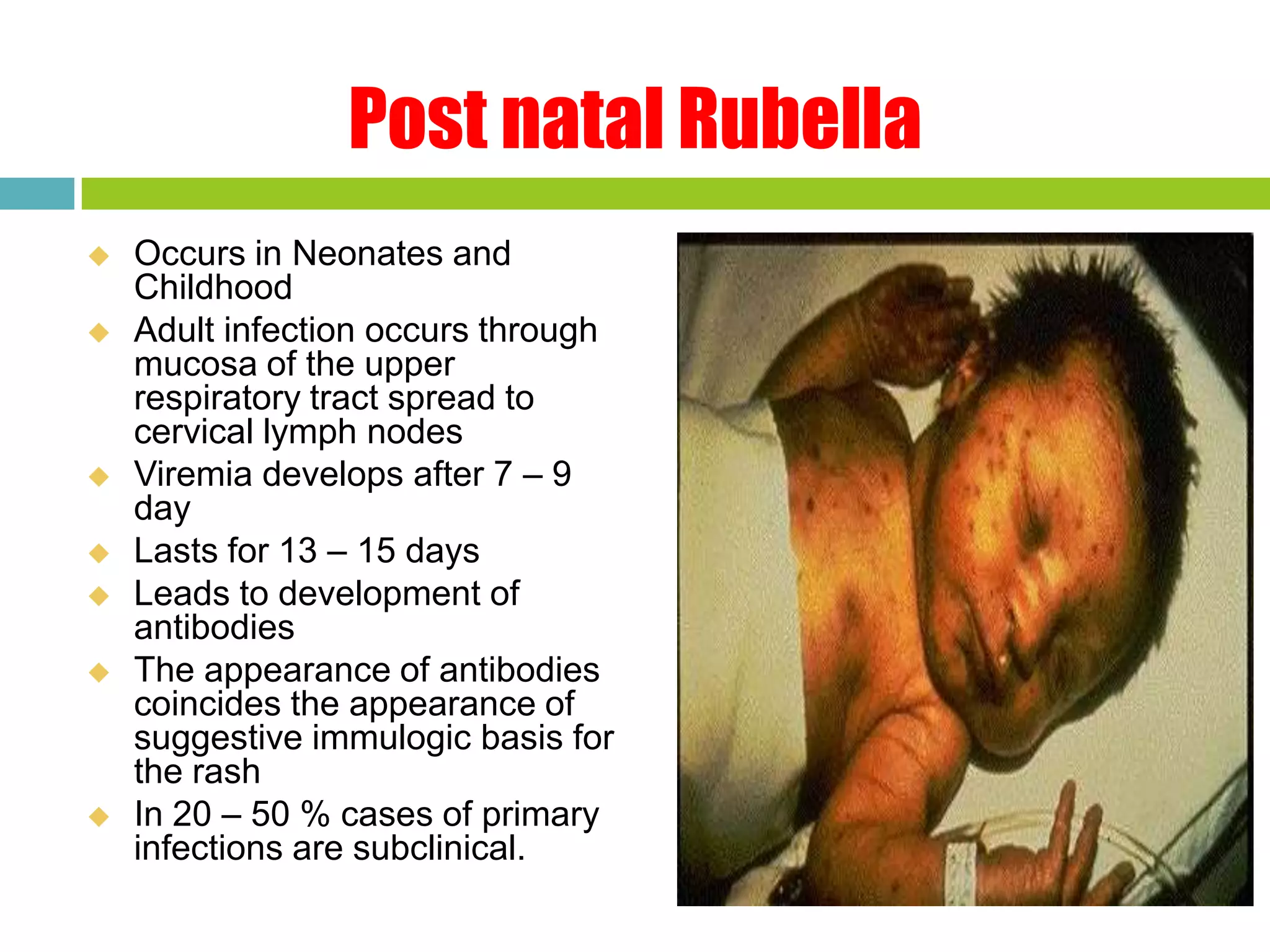 Rubell ppt | PPTX