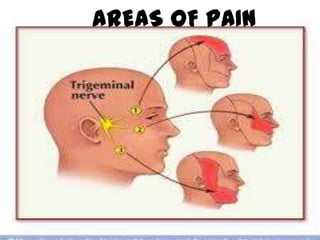 AREAS OF PAIN

 