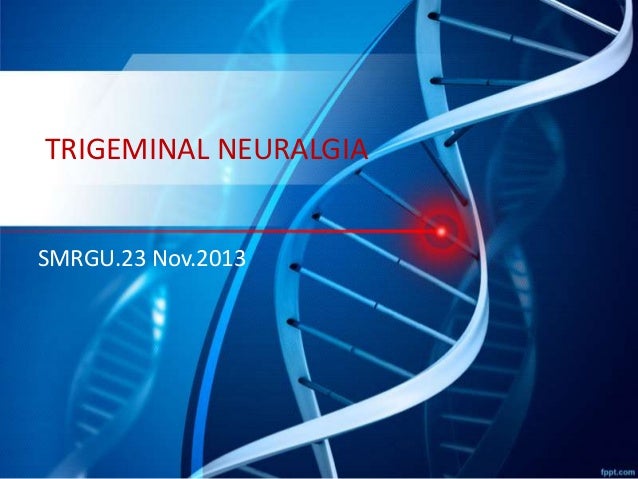 trigeminal-neuralgia