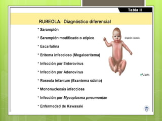 Fruth Rubeola Rubeola | PPTX