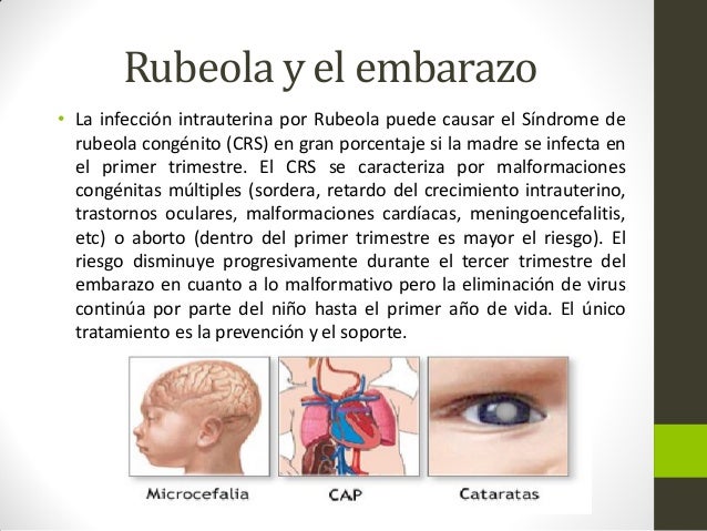 Rubeola