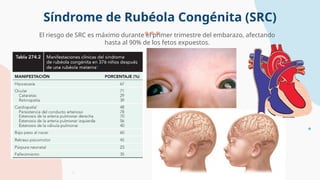 Fruth Rubeola Rubeola mas sindrome de rubeola congenita | PPTX