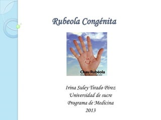 Rubeola Congénita
Irina Suley Tirado Pérez
Universidad de sucre
Programa de Medicina
2013
 