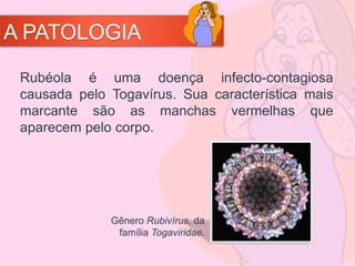 A PATOLOGIA
Rubéola é uma doença infecto-contagiosa
causada pelo Togavírus. Sua característica mais
marcante são as manchas vermelhas que
aparecem pelo corpo.
Gênero Rubivírus, da
família Togaviridae.
 