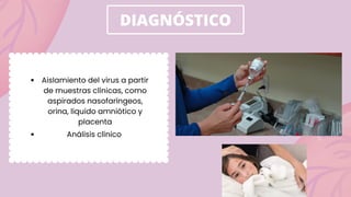 DIAGNÓSTICO
Aislamiento del virus a partir
de muestras clínicas, como
aspirados nasofaríngeos,
orina, líquido amniótico y
placenta
Análisis clínico
 