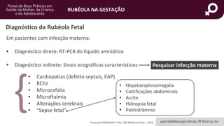 portaldeboaspraticas.iff.fiocruz.br
RUBÉOLA NA GESTAÇÃO
Protocolo FEBRASGO nº 96, CNE Medicina Fetal – 2018.
Diagnóstico da Rubéola Fetal
Em pacientes com infecção materna:
• Diagnóstico direto: RT-PCR do líquido amniótico
• Diagnóstico indireto: Sinais ecográficos característicos Pesquisar infecção materna
• Hepatoesplenomegalia
• Calcificações abdominais
• Ascite
• Hidropsia fetal
• Polihidrâmnio
{
• Cardiopatias (defeito septais, EAP)
• RCIU
• Microcefalia
• Microftalmia
• Alterações cerebrais
• “Sepse fetal”
 