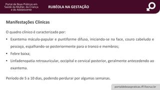 portaldeboaspraticas.iff.fiocruz.br
RUBÉOLA NA GESTAÇÃO
Manifestações Clínicas
O quadro clínico é caracterizado por:
• Exantema máculo-papular e puntiforme difuso, iniciando-se na face, couro cabeludo e
pescoço, espalhando-se posteriormente para o tronco e membros;
• Febre baixa;
• Linfadenopatia retroauricular, occipital e cervical posterior, geralmente antecedendo ao
exantema.
Período de 5 a 10 dias, podendo perdurar por algumas semanas.
 