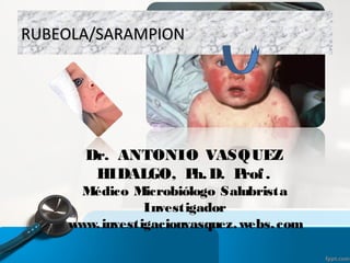 RUBEOLA/SARAMPIONRUBEOLA/SARAMPION
Dr. ANTONIO VASQUEZ
HIDALGO, Ph.D. Prof.
Médico Microbiólogo Salubrista
Investigador
www.investigacionvasquez.webs.com
 