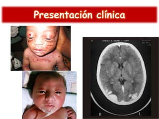 Presentación clínica

 