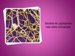 Bactéria de Leptospirose
vista sobre microscópio.
 