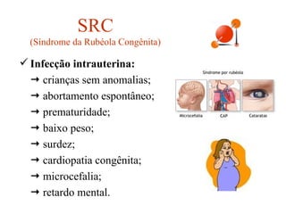 SRC (Síndrome da Rubéola Congênita) Infecção intrauterina:      crianças sem anomalias;    abortamento espontâneo;    prematuridade;    baixo peso;    surdez;    cardiopatia congênita;    microcefalia;    retardo mental. 