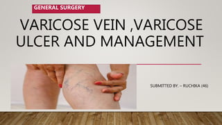 VARICOSE VEIN ,VARICOSE
ULCER AND MANAGEMENT
SUBMITTED BY. – RUCHIKA (46)
GENERAL SURGERY
 