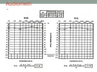 Audiometri
a

 