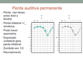 Perda auditiva permanente
• Perda nas faixas

•
•
•

•
•

entre 4mil e
6milHz
Perda bilateral +/_
simétrica
Pode haver
assimetria
Exposição
unilateral gera
perda bilateral
Zumbido em 1/3
Recrutamento

 