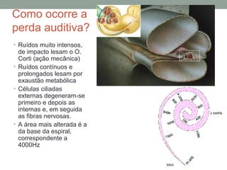 Como ocorre a
perda auditiva?
• Ruídos muito intensos,

de impacto lesam o O.
Corti (ação mecânica)
• Ruídos contínuos e
prolongados lesam por
exaustão metabólica
• Células ciliadas
externas degeneram-se
primeiro e depois as
internas e, em seguida
as fibras nervosas.
• A área mais alterada é a
da base da espiral,
correspondente a
4000Hz

 