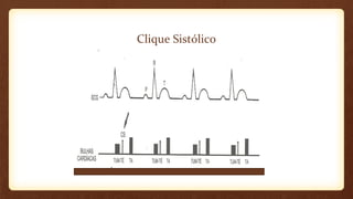 Clique Sistólico
 