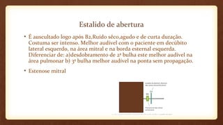 Estalido de abertura
• É auscultado logo após B2,Ruído sêco,agudo e de curta duração.
Costuma ser intenso. Melhor audível com o paciente em decúbito
lateral esquerdo, na área mitral e na borda esternal esquerda.
Diferenciar de: a)desdobramento de 2ª bulha este melhor audível na
área pulmonar b) 3ª bulha melhor audível na ponta sem propagação.
• Estenose mitral
 