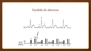 Estalido de abertura
 