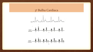 3ª Bulha Cardíaca
 