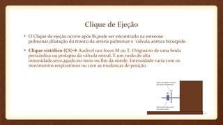Clique de Ejeção
• O Clique de ejeção ocorre após B1,pode ser encontrado na estenose
pulmonar,dilatação do tronco da artéria pulmonar e válvula aórtica bicúspide.
• Clique sistólico (CS) Audível nos focos M ou T. Originário de uma brida
pericárdica ou prolapso da válvula mitral. É um ruído de alta
intensidade,seco,agudo,no meio ou fim da sístole. Intensidade varia com os
movimentos respiratórios ou com as mudanças de posição.
 