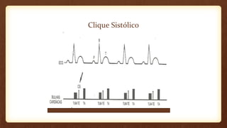 Clique Sistólico
 