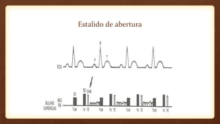 Estalido de abertura
 