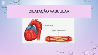 DILATAÇÃO VASCULAR
 