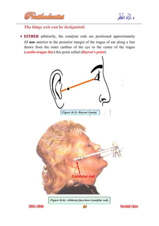 Condylar Rods Complete denture prosthodontics 2016 | PDF