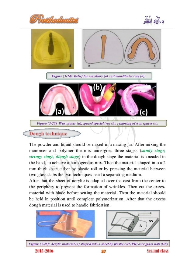 Complete denture prosthodontics 2016