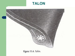 TALON
 