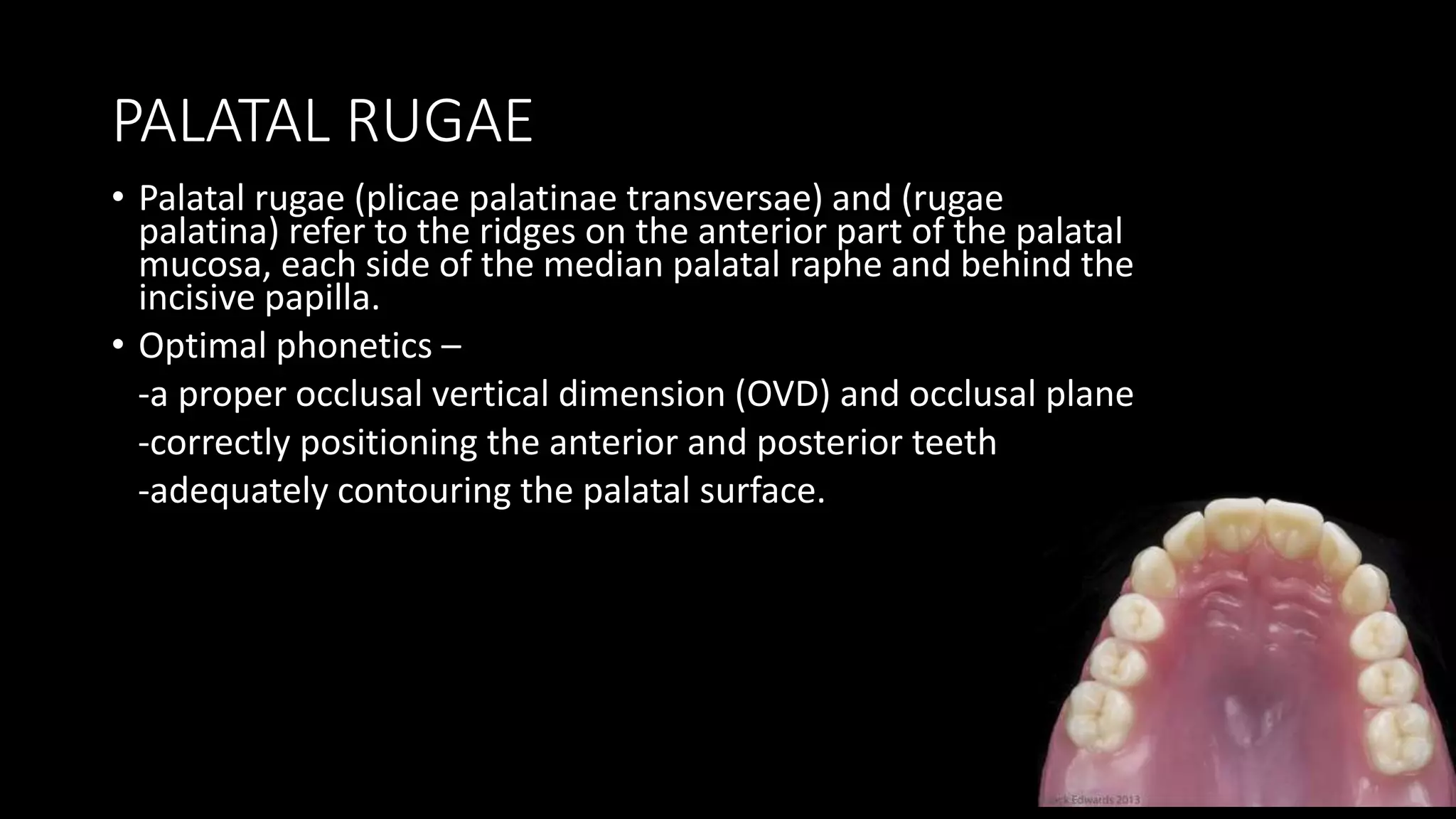Normal Palatal Rugae Rugae fabrication | PPTX