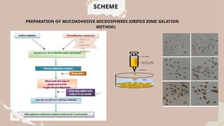 Formulation and evaluation of mucoadhesive microspheres containing ...