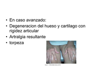 En caso avanzado: Degeneracion del hueso y cartilago con rigidez articular Artralgia resultante torpeza 