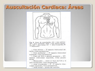 Auscultación Cardiaca: Áreas
 