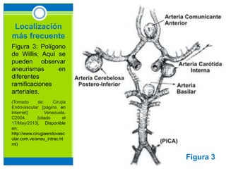 Localización
más frecuente
Figura 3: Polígono
de Willis; Aquí se
pueden observar
aneurismas en
diferentes
ramificaciones
arteriales.
(Tomado de: Cirujía
Endovascular [página en
Internet] Venezuela.
C2004. [citado el
17/May/2013]. Disponible
en:
http://www.cirugiaendovasc
ular.com.ve/aneu_intrac.ht
ml)
Figura 3
 