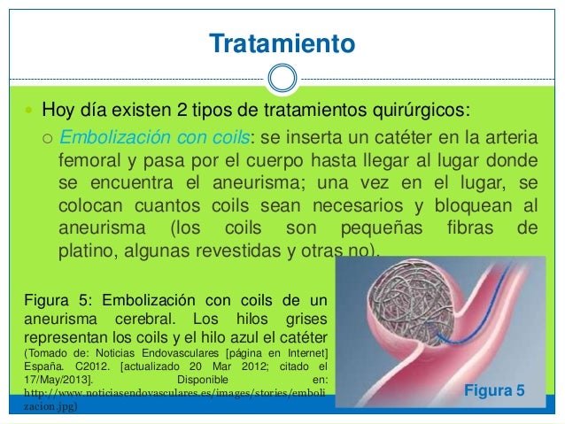 Si puede gira la cabeza a la osteocondrosis del cuello