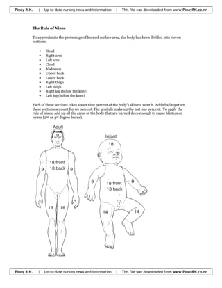 |   Up-to-date nursing news and information      |   This file was downloaded from www.PinoyRN.co.nr
Pinoy R.N.




         The Rule of Nines

         To approximate the percentage of burned surface area, the body has been divided into eleven
         sections:

                 Head
             •
                 Right arm
             •
                 Left arm
             •
                 Chest
             •
                 Abdomen
             •
                 Upper back
             •
                 Lower back
             •
                 Right thigh
             •
                 Left thigh
             •
                 Right leg (below the knee)
             •
                 Left leg (below the knee)
             •

         Each of these sections takes about nine percent of the body's skin to cover it. Added all together,
         these sections account for 99 percent. The genitals make up the last one percent. To apply the
         rule of nines, add up all the areas of the body that are burned deep enough to cause blisters or
         worse (2nd or 3rd degree burns).




             |   Up-to-date nursing news and information      |   This file was downloaded from www.PinoyRN.co.nr
Pinoy R.N.
 