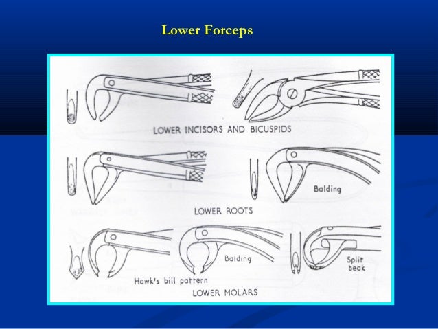 Rules of using dental forceps & elevator